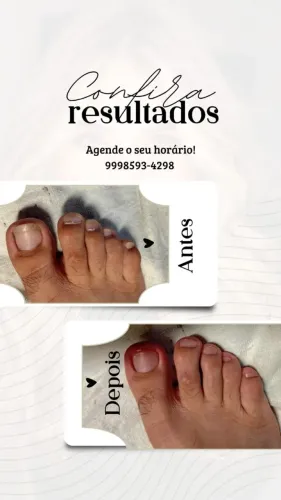 Manicure 