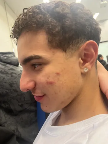 vindo enzo