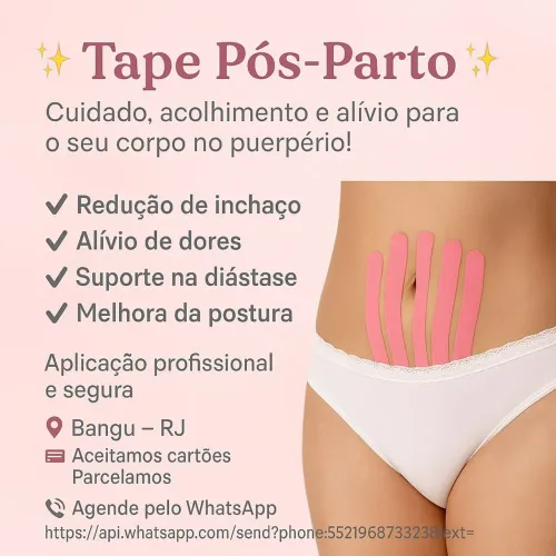 Tape pós parto
