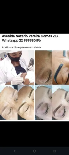 Sobrancelhas Definitivas - Micropigmentação -fio a fio