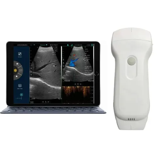 ? Ecógrafo Portátil Ultrassom 3 em 1 (Linear, Convexo e Doppler)