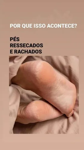 Plástica dos pés 