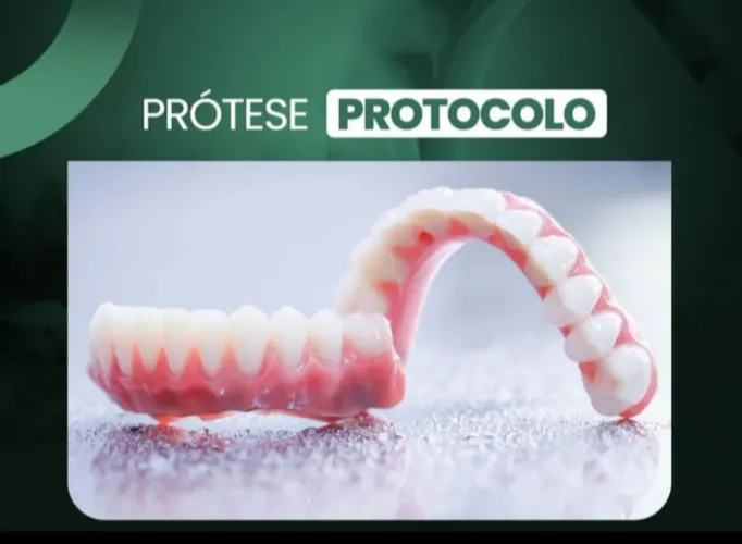 Próteses, implantes parcelado no Boleto