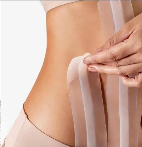 Canaleta pos lipo