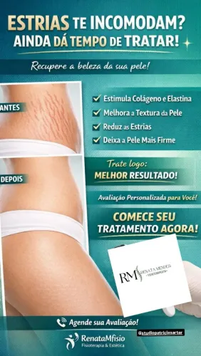 As estrias te incomodam!