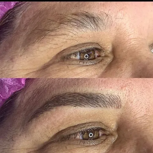 Promoção de Micropigmentação?