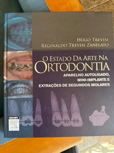 O estado da Arte na Ortodontia - Aparelho autoligado, mini-implante e extrações