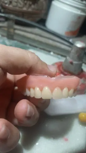 Prótese Dentária