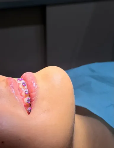 Dentista  procedimentos odontológico 