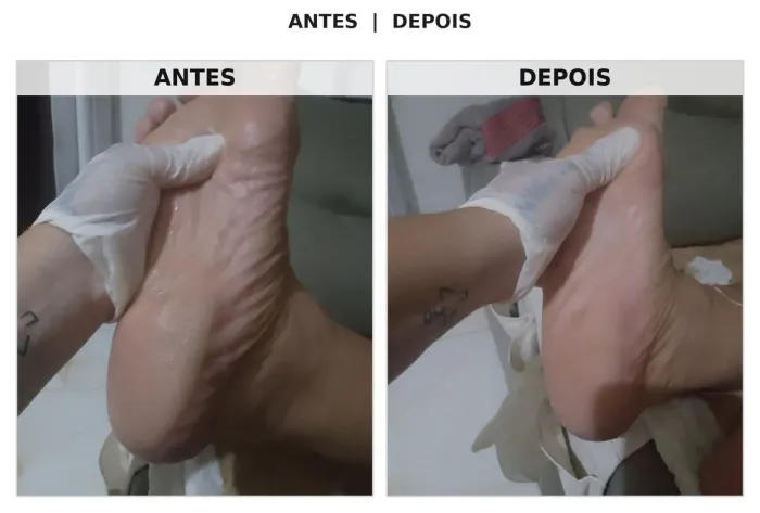 Pedicure