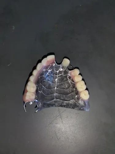 Próteses dentarias de qualidade