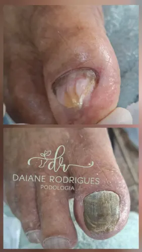 Serviço de podologia domiciliar e clínica