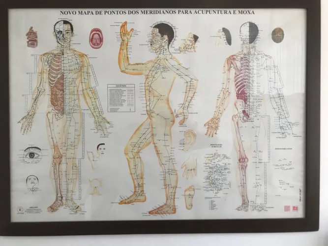 Quadro mapa pontos de acupuntura com moldura e vidro 