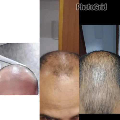 shampoo com Bio ativos. Terapia capilar 