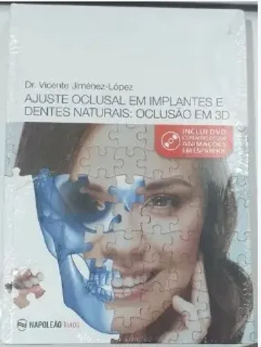 Ajuste Oclusal Em Implantes E Dentes Naturais: Oclusão em 3D - Livro de Odontologia
