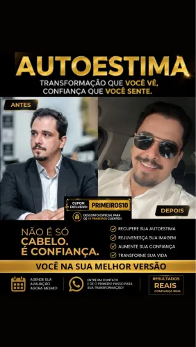 Transplante Capilar