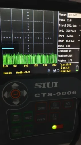 Aparelho de ultrassom