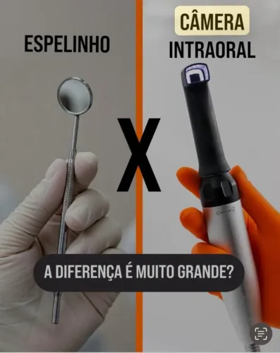 CAMERA INTRAORAL ODONTOLOGICA