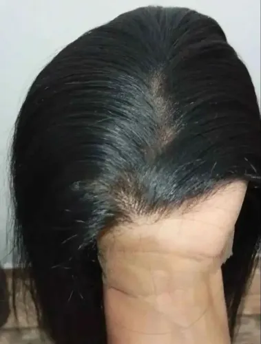Front leice 