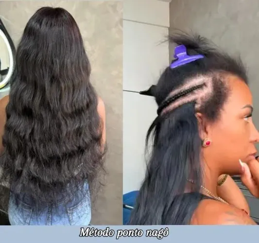 Implantista: especialista em entrelace a domicílio