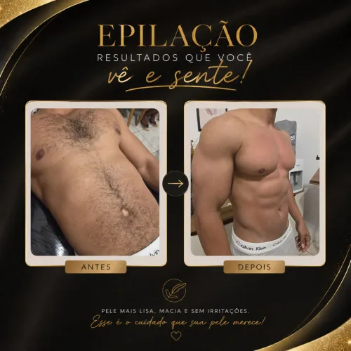 Depilação com cera