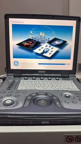 ultrassom portatil