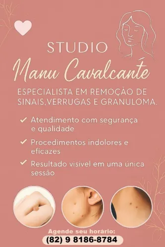 Remoção de Sinais, Verrugas, Granulomas