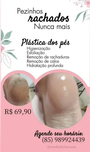 Plástica dos pés 