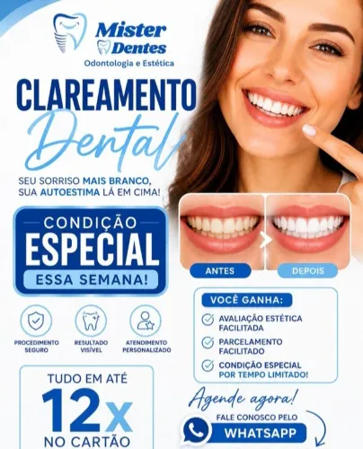 Clareamento dental condições especiais /dentista