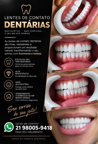 LENTES DENTÁRIAS (PORCELANA E DIAMANTADA)