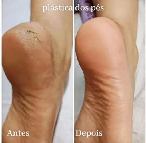Spa dos pés 