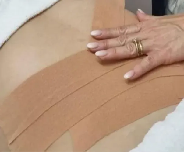 Aplicação de taping 