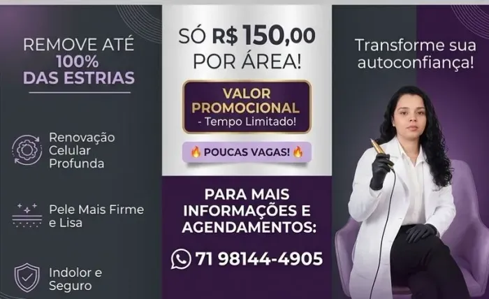 Tratamento para estrias 