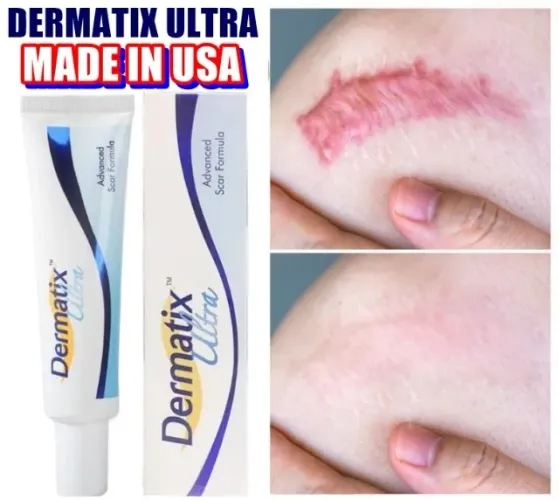 2Un. Dermatix Ultra Gel De Silicone Para Remoção De Cicatrizes 15g