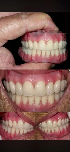 Prótese dentária