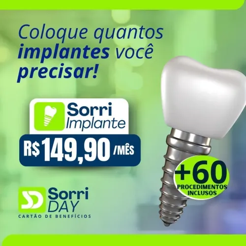 Plano com +60 procedimentos odontológicos inclusos