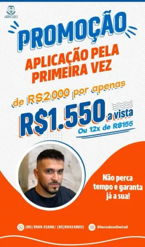 Promoção Imperdível! Aplicação de prótese capilar por R$1.550