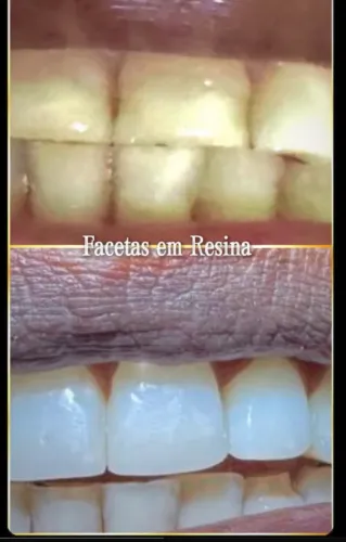 Dentista 