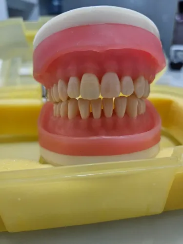 - Manequim Pronew PD100 + 10 dentes cavitados Pronew + 4 Dentes s/coroa Pronew