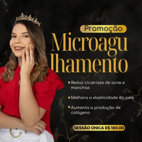 Microagulhamento  - Dom Pedro I 