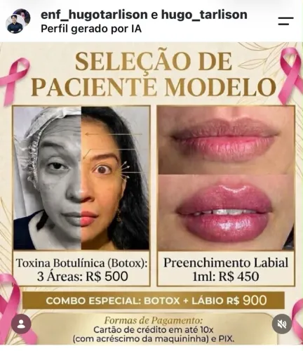 VAGAS PACIENTES MODELOS PARA PREENCHIMENTO LABIAL E BOTOX