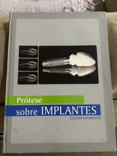 Livro prótese sobre implantes