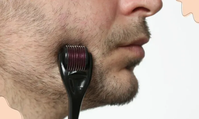 Rolo de microagulha Derma Roller para rosto|corpo|cabelo para barba 0,50mm