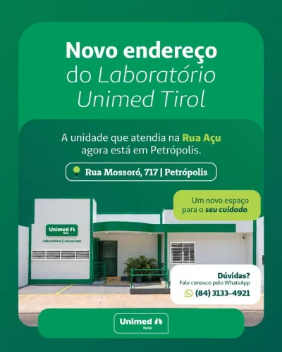 Tampo de mesa de vidro