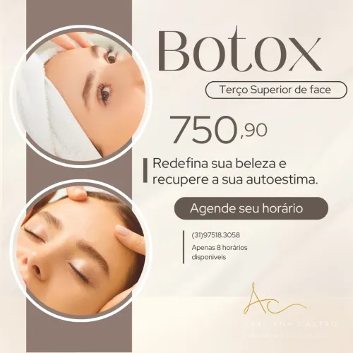 Botox - Terço Superior de Face