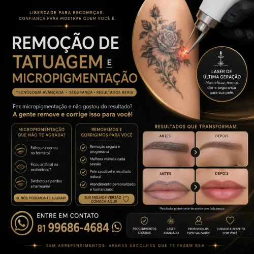 Remoção de micropigmentação e tattoo