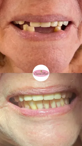Dentista -Manôa 