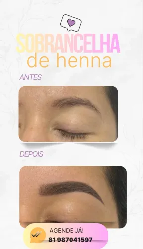 Sobrancelhas 