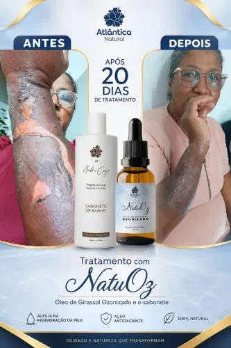 Tratamento estético e dermatológico 