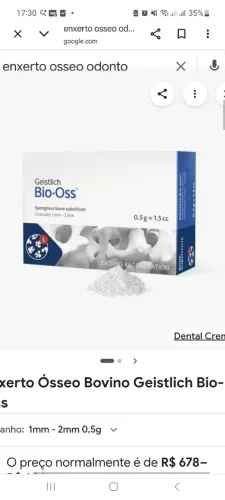 Bio-oss odontologia